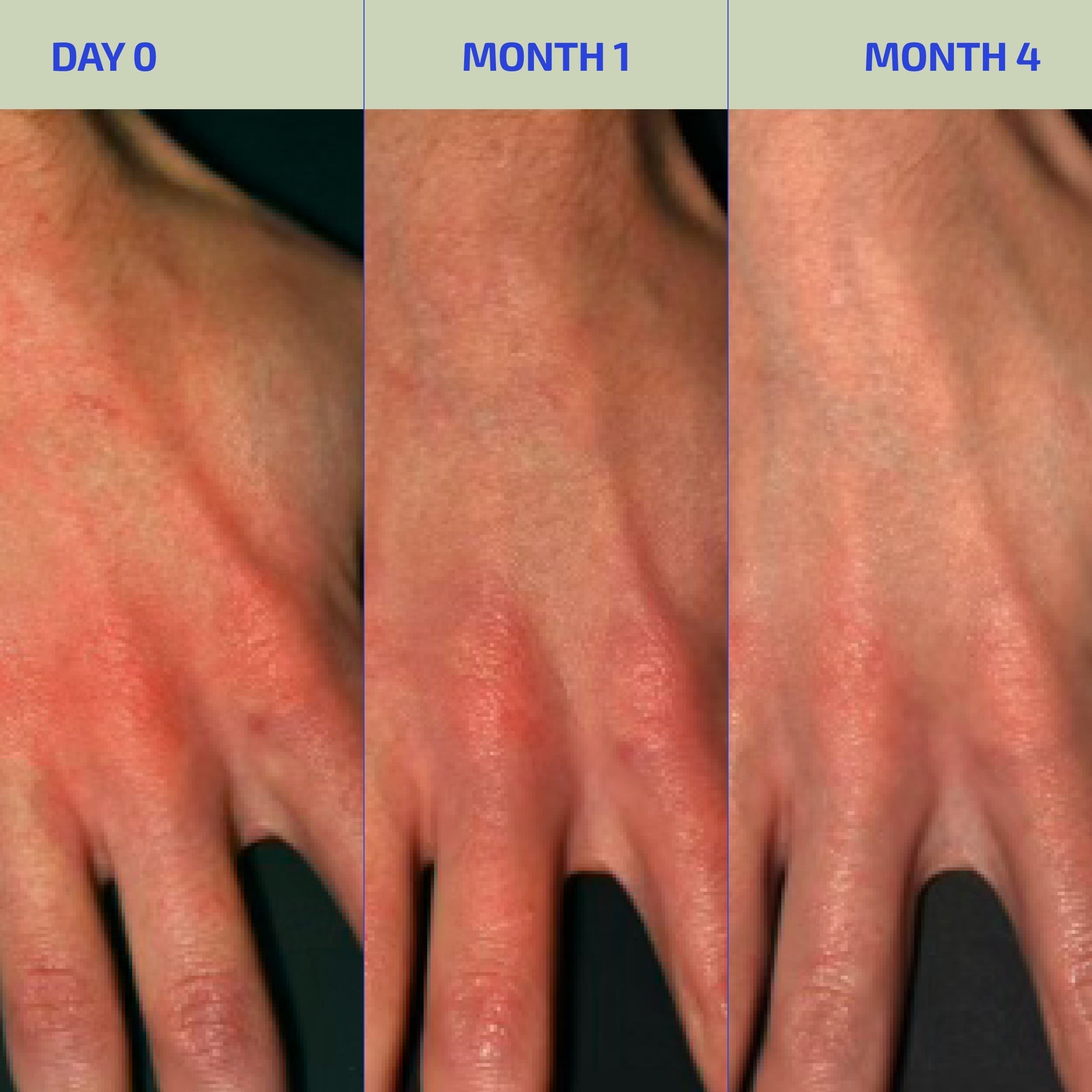 Dry, Sensitive Skin Soothing Duo