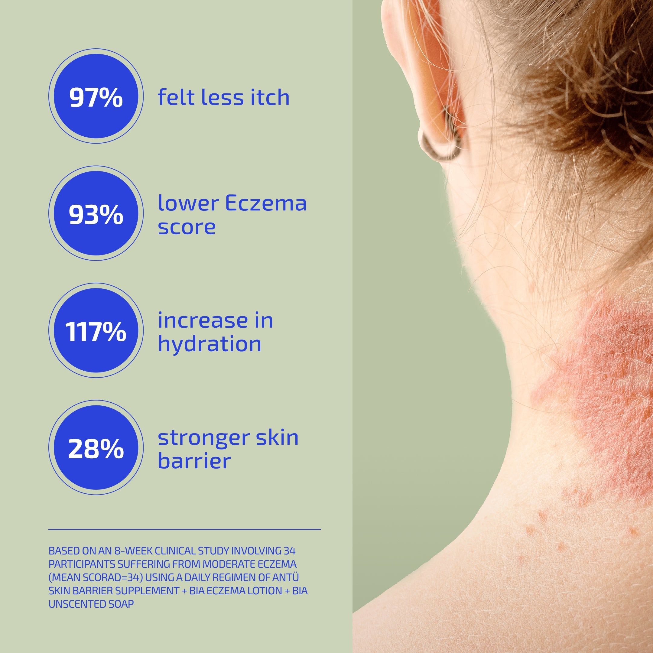 Adult Eczema & Flare Relief - 30-Day Skin Barrier Protocol: Glycerin Soap, Lotion & L-histidine Supplement  (Age: 18+)