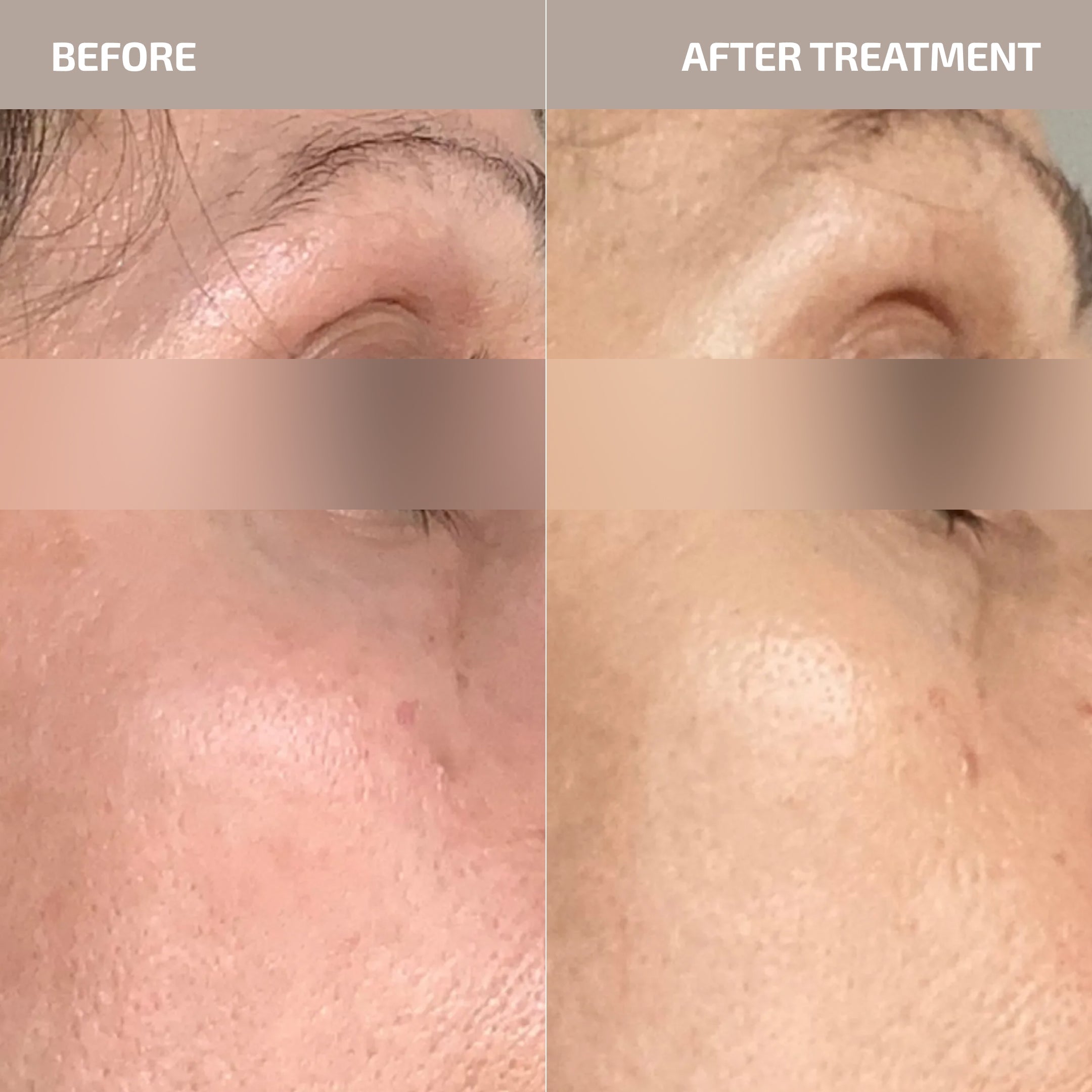 Overnight Repair Cream – Support Collagen & Deep Hydration for Skin Longevity – ANTÜ (Age: 30-60+)