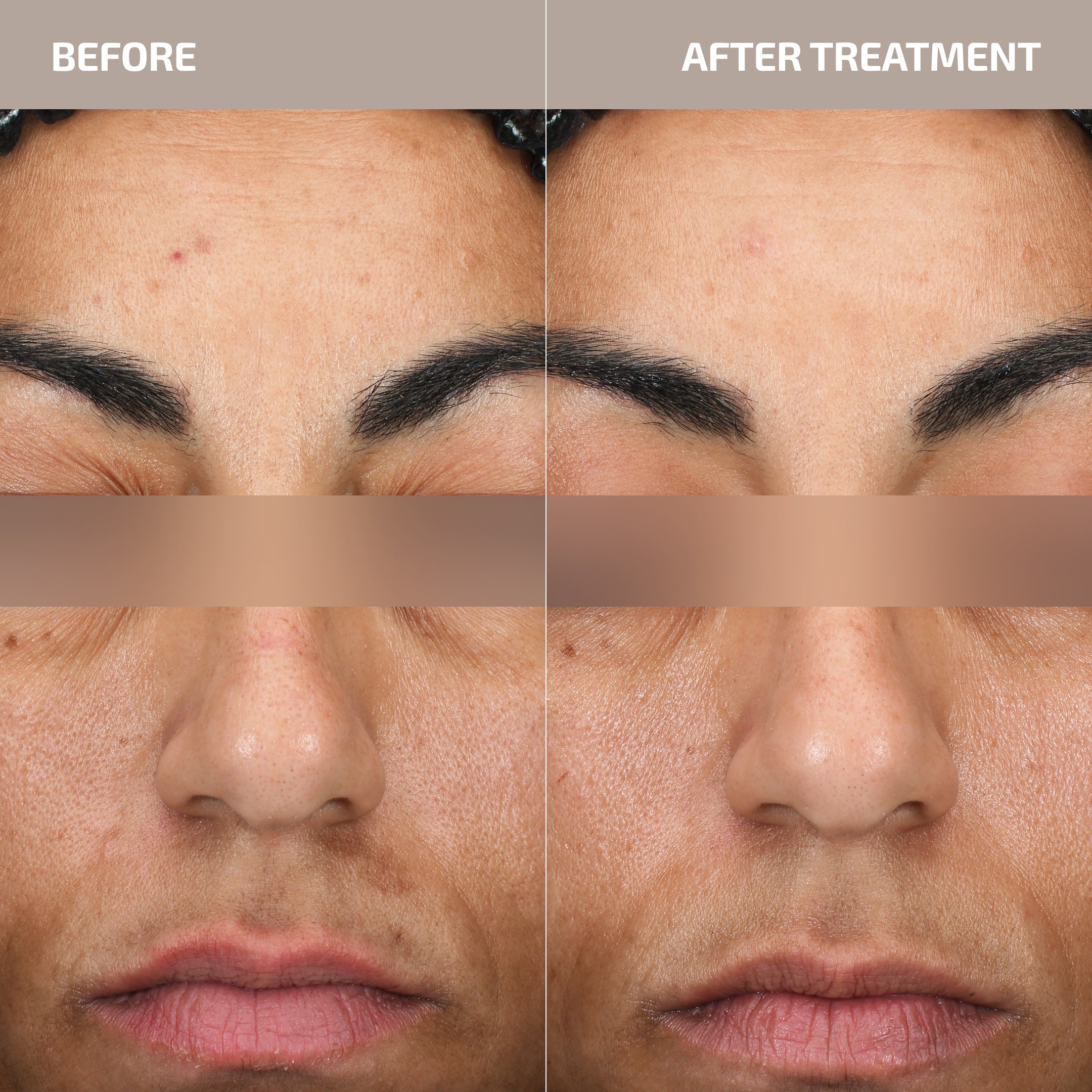 Skin Barrier Restoration Protocol – Cell Mitochondria & Microbiome Support for Skin Longevity (Age: 30-60+)