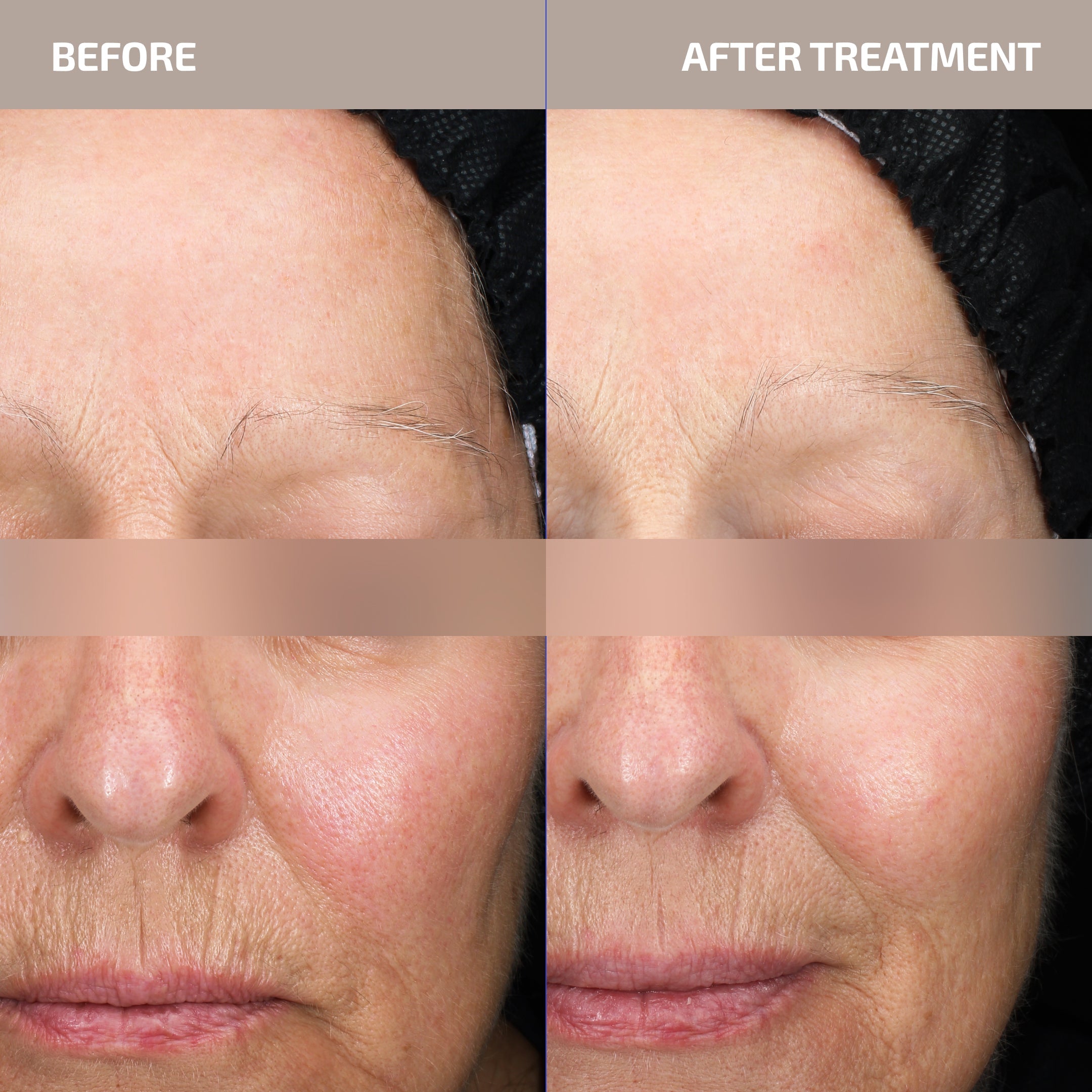 Skin Barrier Repair Serum for Sensitive & Redness-Prone Skin – ANTU