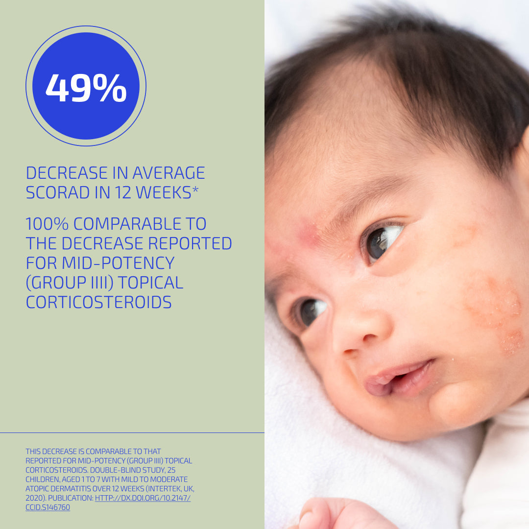 Baby with skin condition next to a statistic about corticosteroid treatment