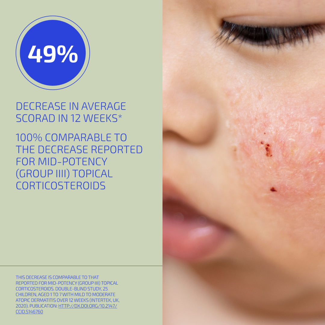 Skin Barrier Eczema-Prone Relief System (Infant: 3-12 months)