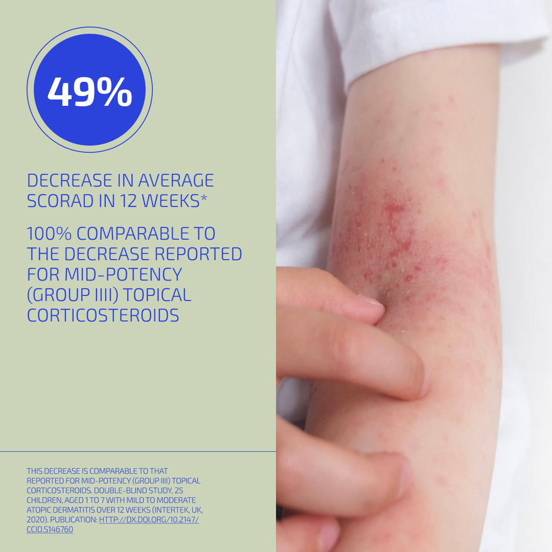 Close-up of a child's arm with redness, alongside text about a 49% decrease in average scorad in 12 weeks.