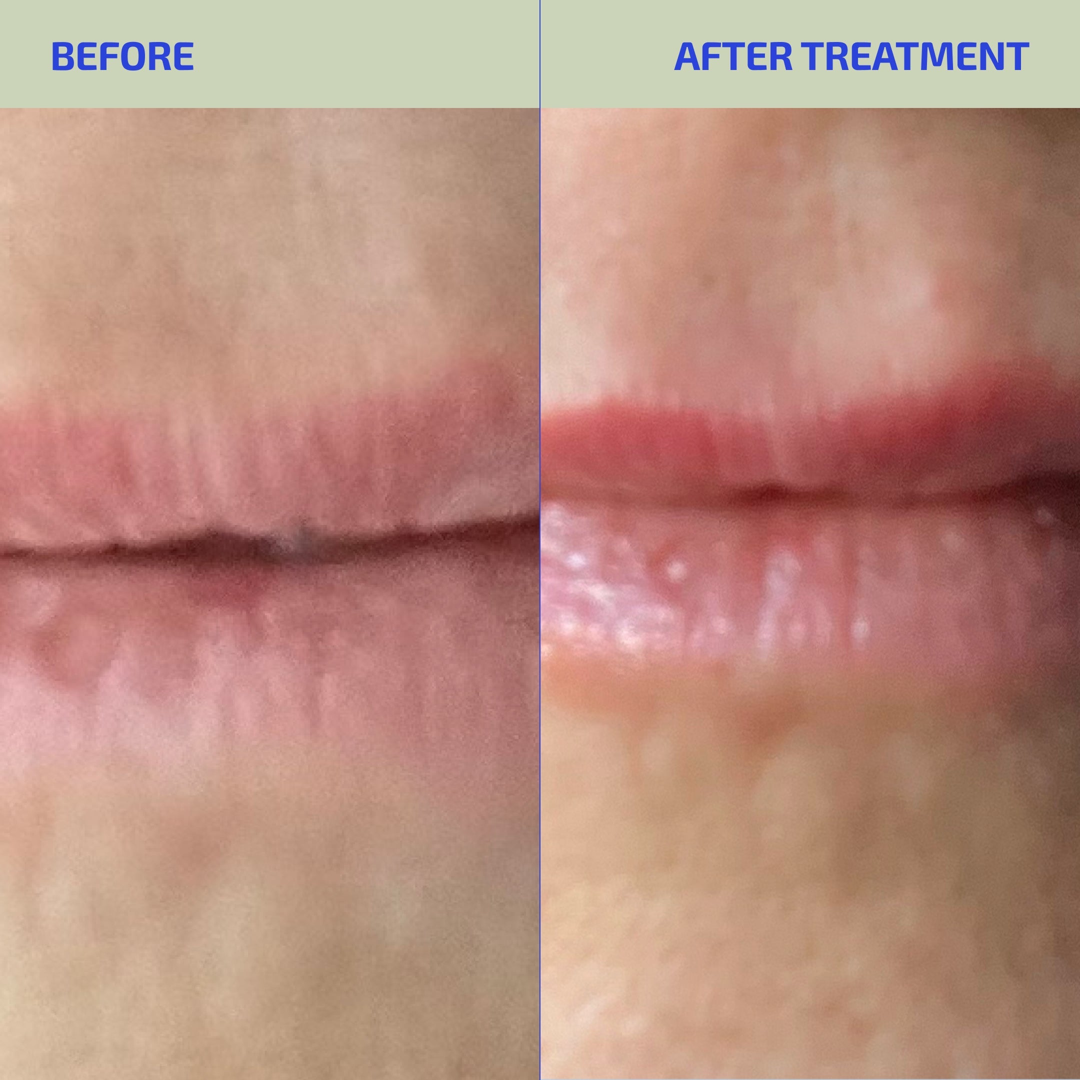 BIA Hydrating Lip Gelee