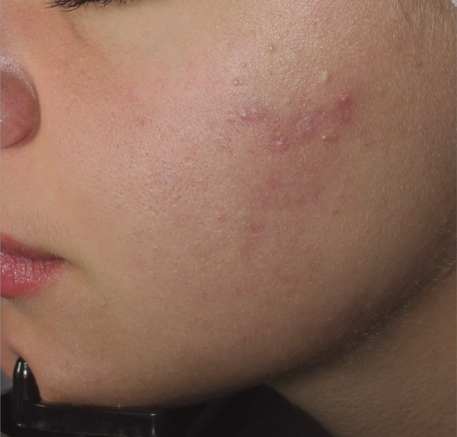 Before Image