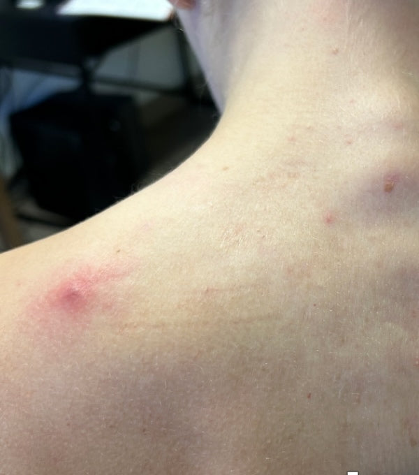 Before Image