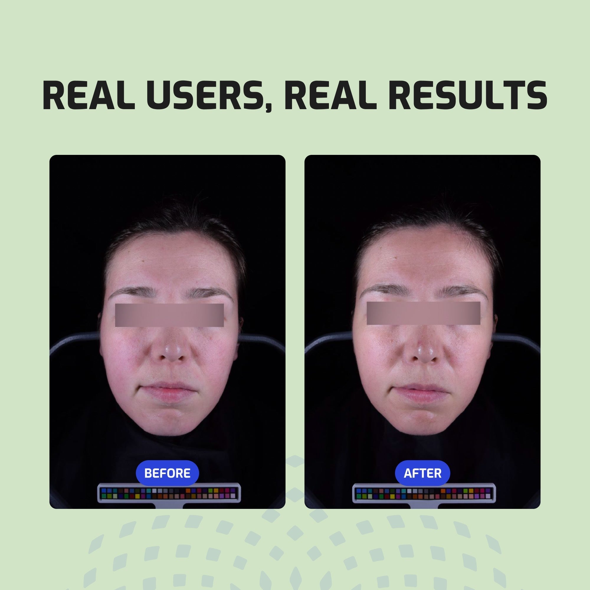 Bia Facial Oil before and after image.